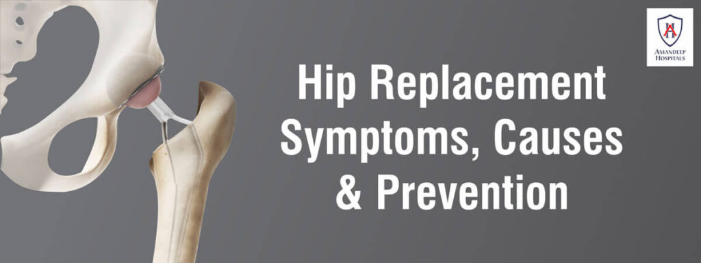 Hip Replacement-Symptoms, Causes & Prevention | Dr.Avtar Singh