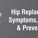 Hip Replacement – Symptoms, causes and prevention